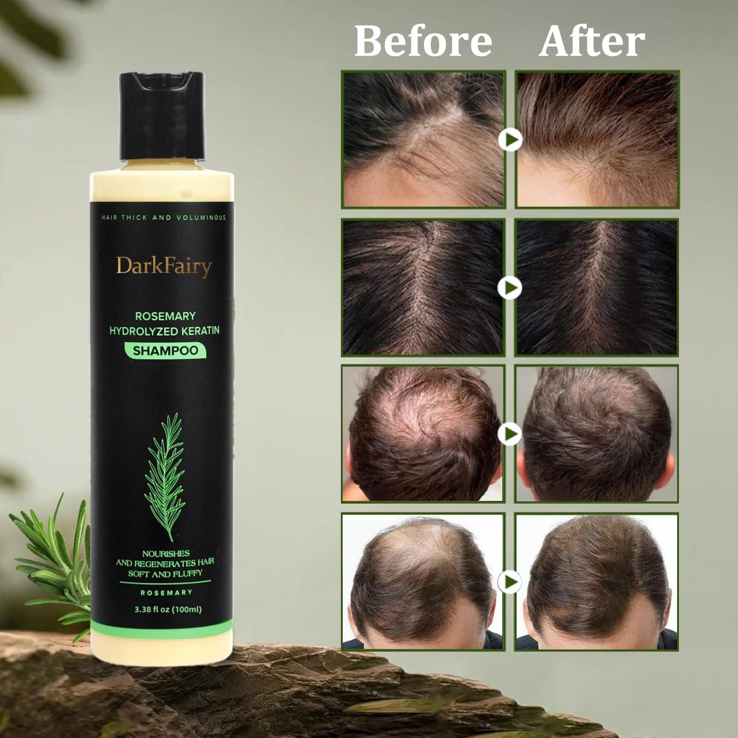 🔥LAST DAY 50% OFF - 🌿 DarkFairy  Organic Rosemary Hair Growth Shampoo