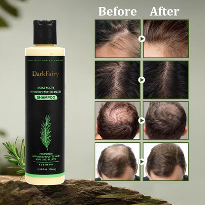 🔥LAST DAY 50% OFF - 🌿 DarkFairy  Organic Rosemary Hair Growth Shampoo